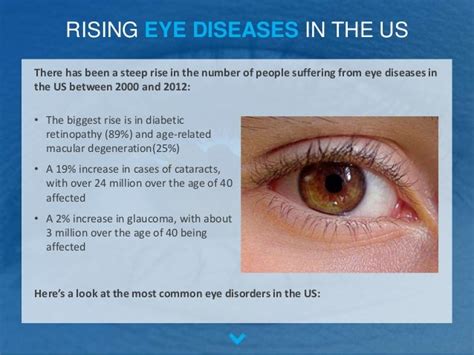 Common Eye Disorders