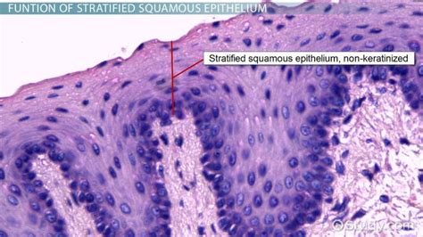 Stratified Squamous Epithelium Keratinized Skin - cloudshareinfo