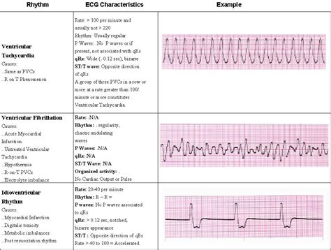 ACLS Rhythms pg 5 of 7 | Saving American Hearts, Inc. AHA ACLS BLS PALS NRP PHTLS CPR First Aid ...