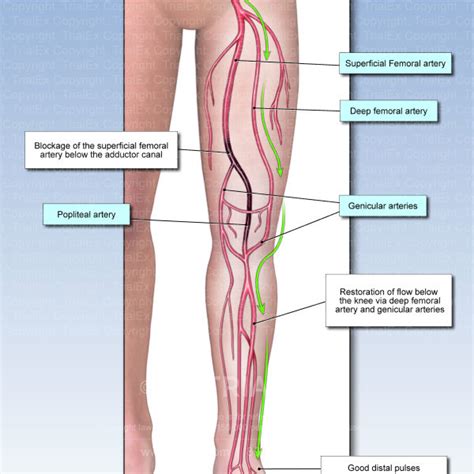 Collateral Flow Bypassing Blockage of the Superficial Femoral Art...