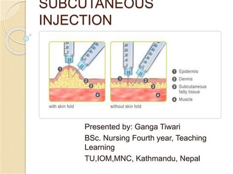 Subcutaneous Injection