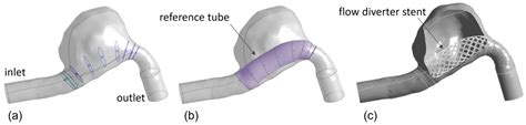 Fluids | Free Full-Text | Hemodynamic Investigation of the Flow ...