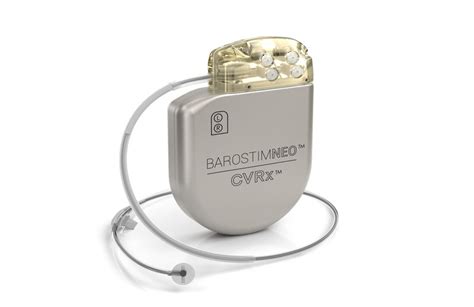 Study backs CVRx Barostim neuromod for heart failure patients