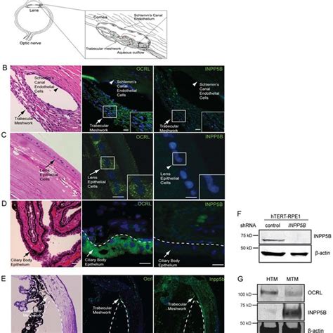 (A) Diagram of trabecular meshwork and Schlemm’s canal endothelial... | Download Scientific Diagram