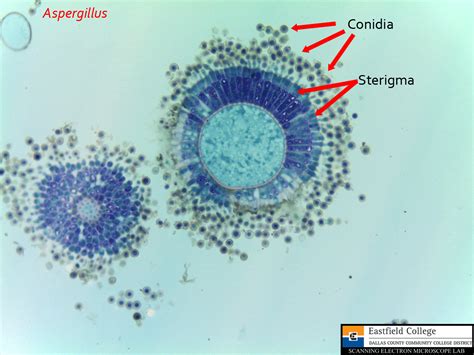 Scanning Electron Microscope Blog: Fungi - Images for Eastfield College ...