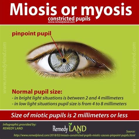 Image result for miosis | Lpn nursing school, Emergency room nurse ...