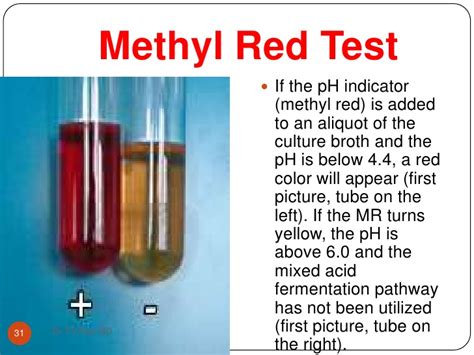 Methyl red (MR) test: objective, principle, procedure and result ...