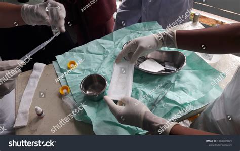 48 Maggot Therapy Debridement Images, Stock Photos & Vectors | Shutterstock