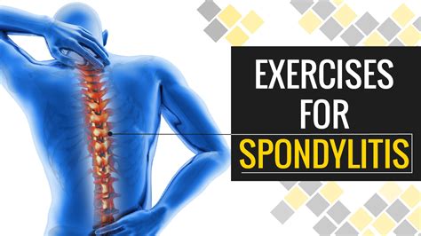 5 Minute Exercise to Get Rid of Spondylosis and Neck Pain | Truweight - YouTube