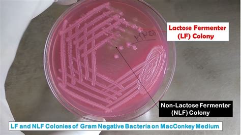 Lactose fermenter colony and Non-lactose fermenter Colony morphology of Gram-Negative Bacteria