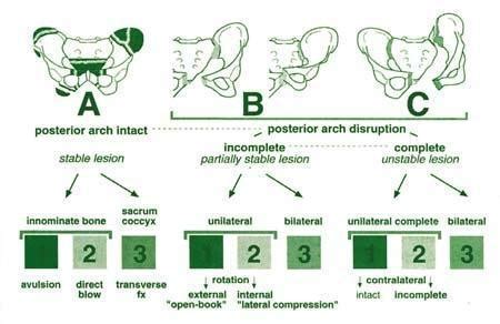 Fractura de pelvis | Flowchart