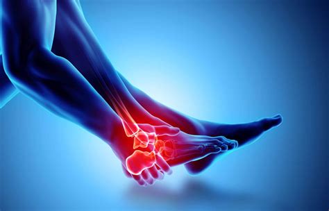 Sprained Ankles | Types, Causes & Recovery Time | OPA Ortho