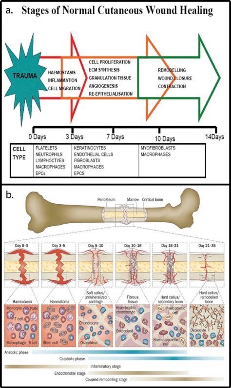 Timelines outlining successive stages in the processes of wound healing ...