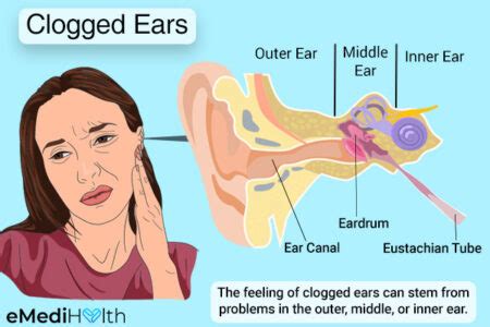 Clogged Ears: Causes, Symptoms, and Treatment Options