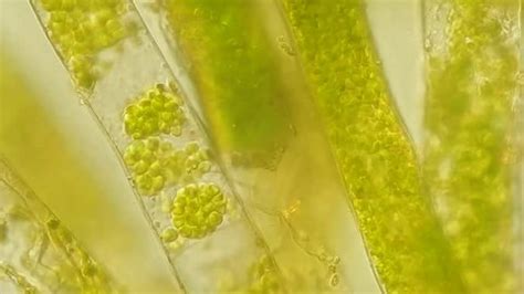 Seaweed Algae Vaucheria Under Microscope Magnification Stock Footage Video (100% Royalty-free ...