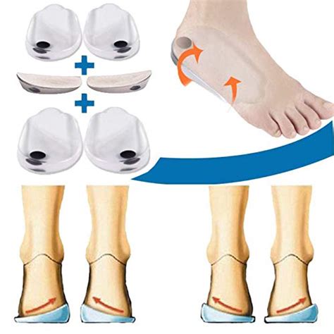 Best Orthotics For Supination: How To Choose The Right Pair