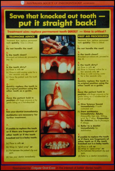 Avulsion | Pocket Dentistry