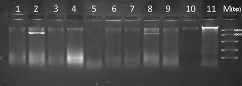 Electrophoresis of nucleic acid samples in 1% agarose gel, 90 V for T.... | Download Scientific ...