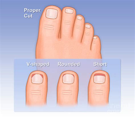 Proper Toenail Cutting Photograph by Medical Imagery Studios/design Pics/science Photo Library