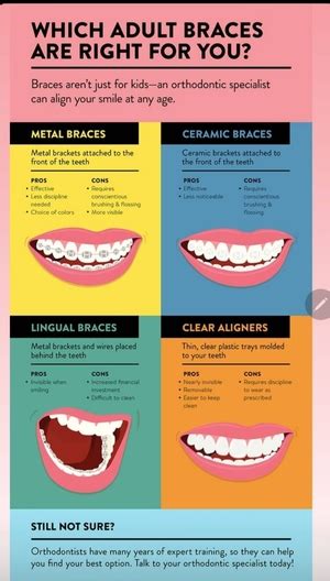 Different types of braces and pros, cons of braces | Dr. Prathmesh ...