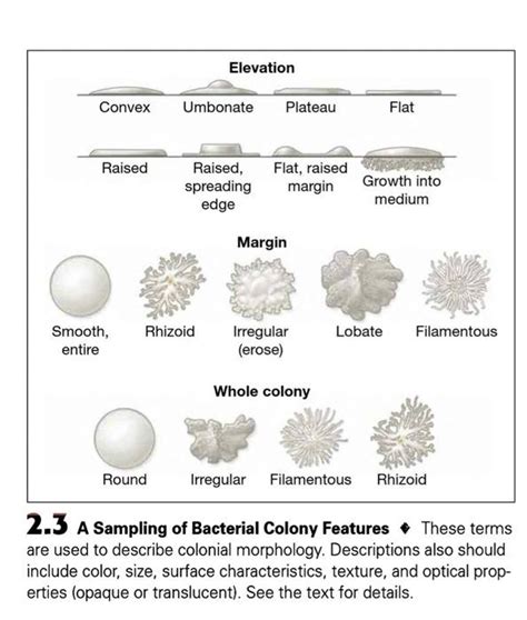 Solved 2-1 Colony Morphology OBSERVATIONS AND | Chegg.com