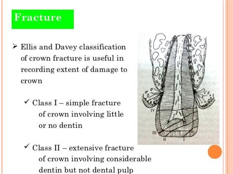 Traumatic injuries of teeth