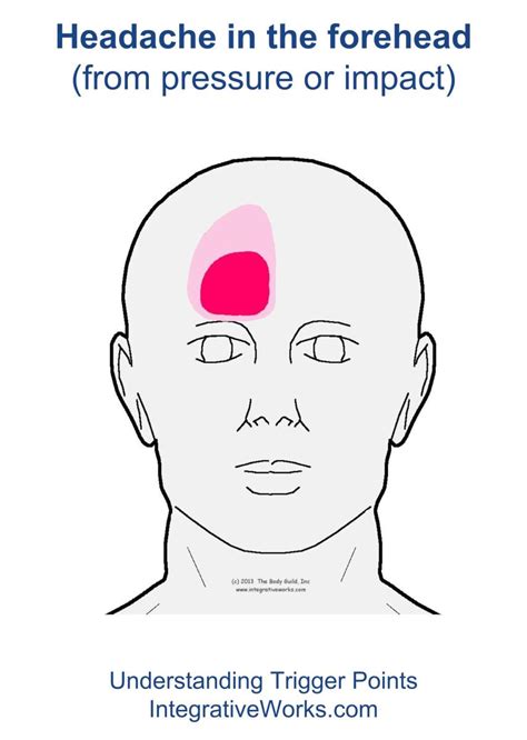 Headache in forehead from pressure or impact | Integrative Works