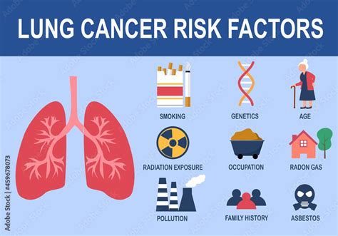 Lung cancer risk factors infographic vector illustration. Stock Vector | Adobe Stock