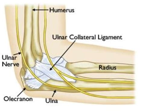 What is Tommy John surgery? (And why the name?) - Northeast Orthopedics ...