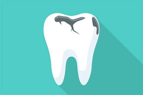 Can a Root Canal Treatment Reverse Tooth Decay?