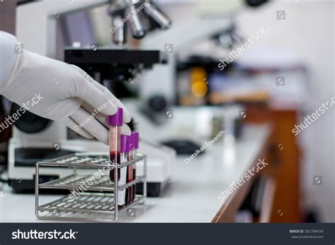 Blood Edta Tube Test Complete Blood Stock Photo 581784934 | Shutterstock