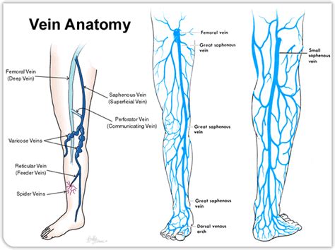 Whatsupic - Natural Solutions for Varicose Veins | Sekolah, Pendidikan ...