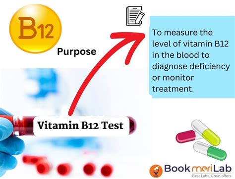 Vitamin B12 Test: Price, Purpose, Results & Sample Report