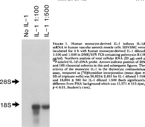 Figure 1 from Human interleukin 1 induces interleukin 1 gene expression ...