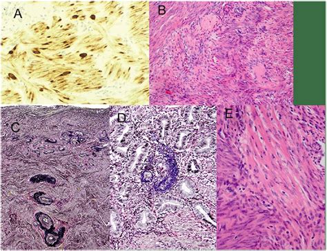 Myometrium Histology