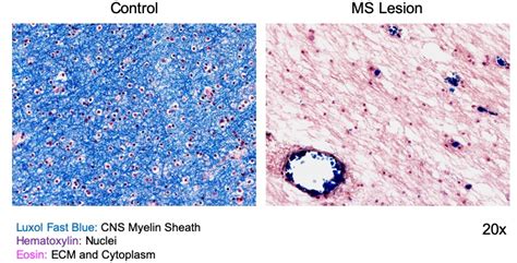 Researchers discover novel regulators of myelin repair and regeneration