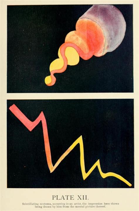 Biomedical Ephemera, or: A Frog for Your Boils — Impression of scintillating scotoma occurring in...