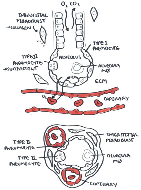 Interstitial Lung Disease - Armando Hasudungan