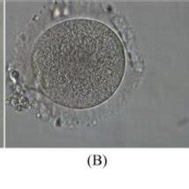 Human oocytes at different maturation stages. A: immature oocyte (GV... | Download Scientific ...