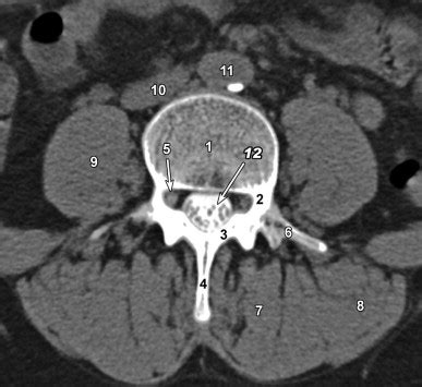 Lumbar Spine Anatomy | Radiology Key