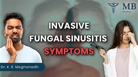 Invasive fungal sinus infection symptoms | Dr. K. R. Meghanadh | Medyblog - YouTube