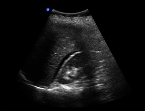 FAST Images | Emergency Ultrasonography