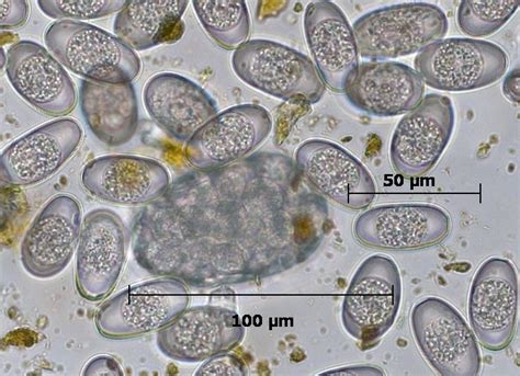 coccidia in cats under microscope - Jefferson Gaither