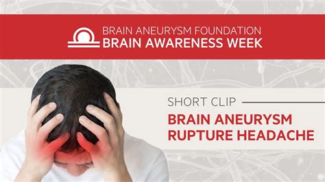 What are the signs of a brain aneurysm headache? - YouTube