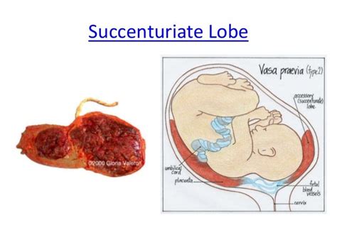 The placenta - odds and sods