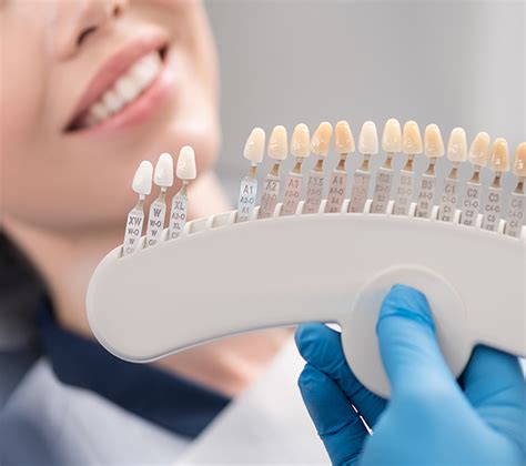 Dental Veneers - GDC Smiles Gainesville Georgia