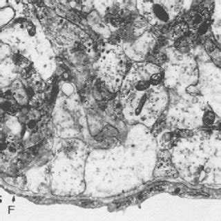 Electromicrograph of the external layer of the median eminence of a rat... | Download Scientific ...