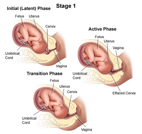 Describe the Three Stages of Labor