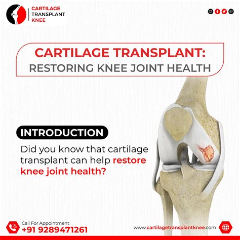 Empowering Knees: Unlocking the Secrets of Regenerative Medicine by Cartilage Transplant Knee ...