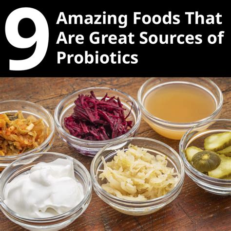 9 Amazing Foods That Are Great Sources of Probiotics - Nature's Branch